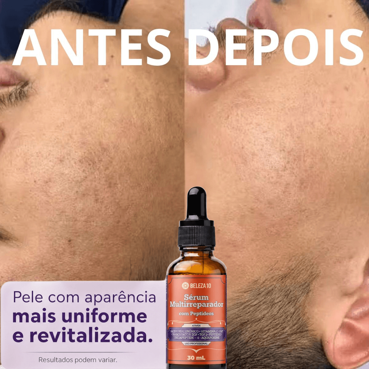 Antes e Depois
