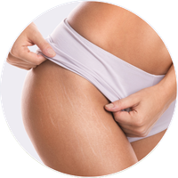 manchas beleza10 7
