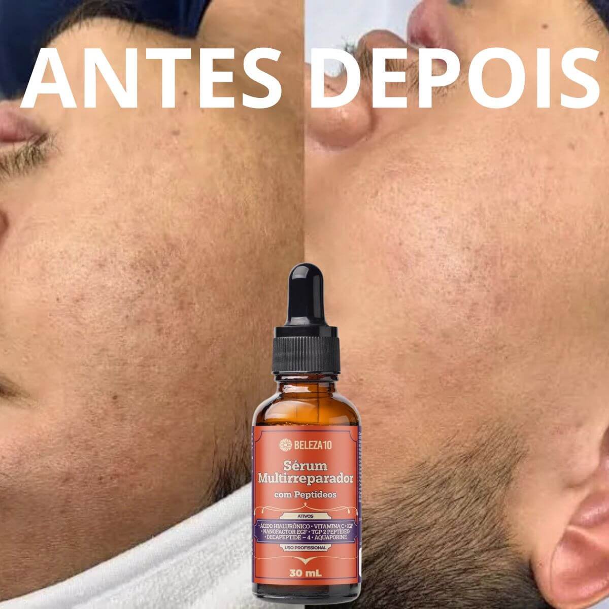 Benefícios do Sérum Multirreparador com Peptídeos Beleza10